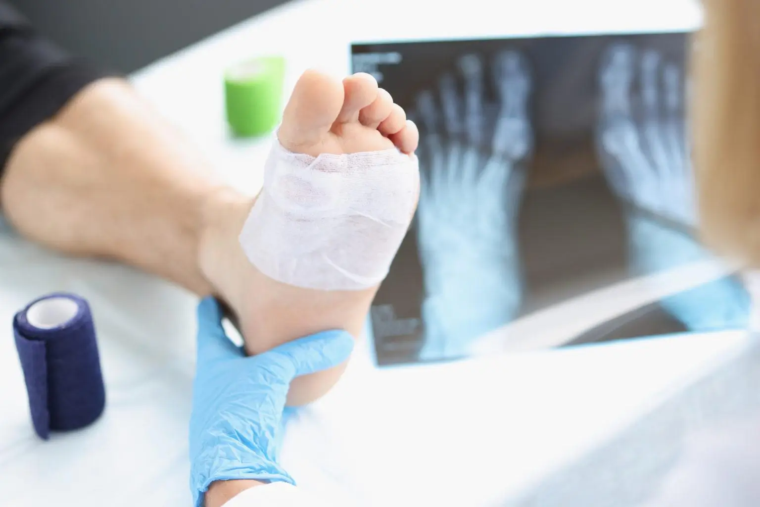 Diabetic Wound Care Midlothian VA